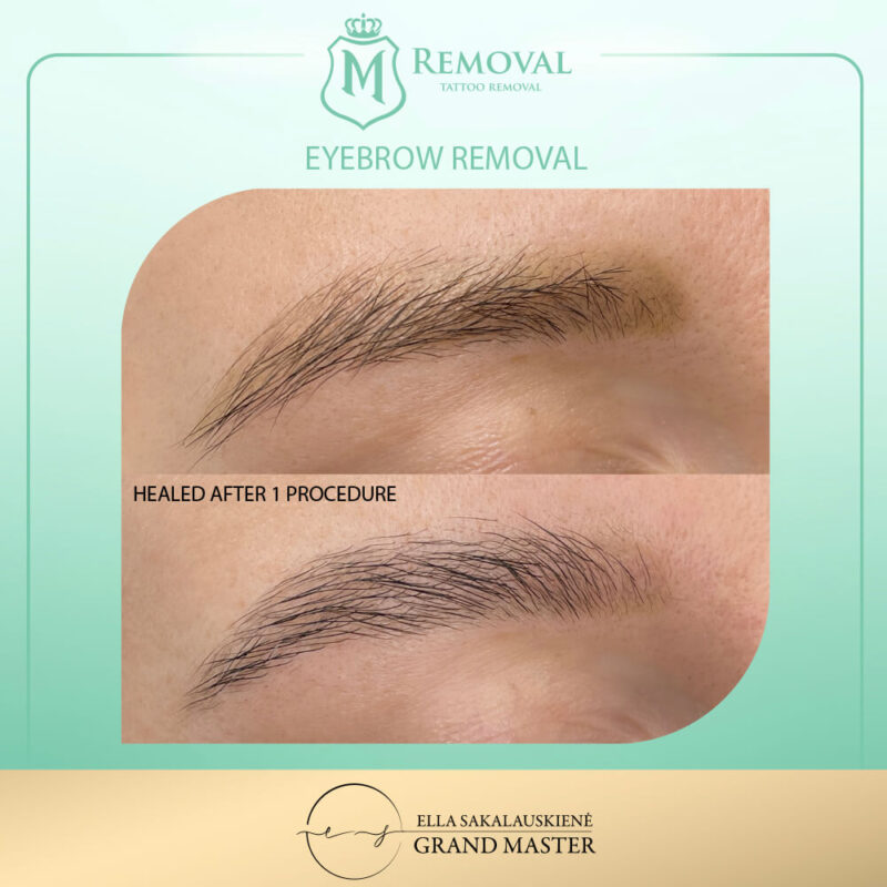 Eyebrow_01
