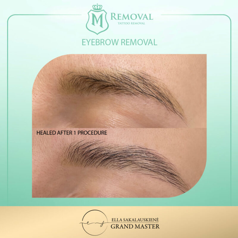 Eyebrow_02