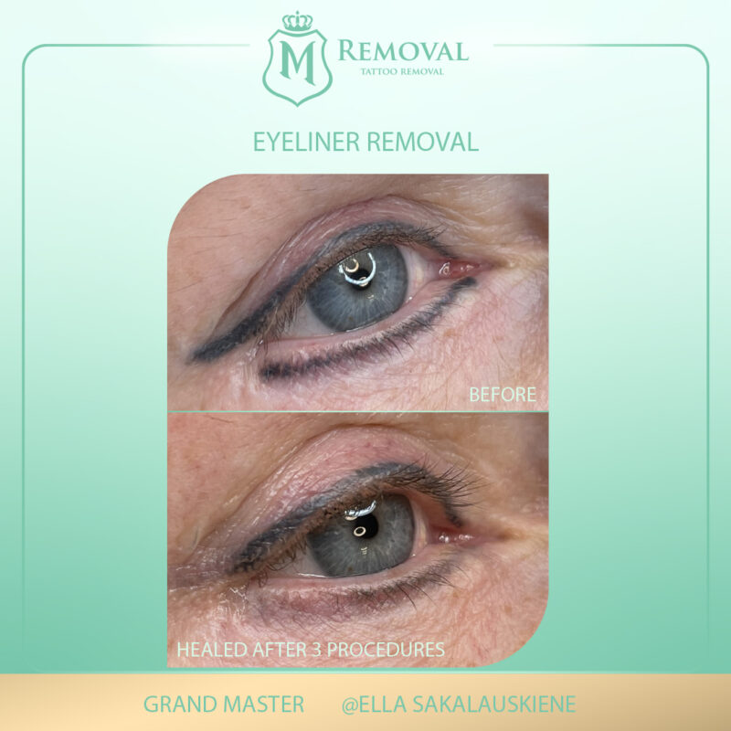 m removal_eyeliner_ella5
